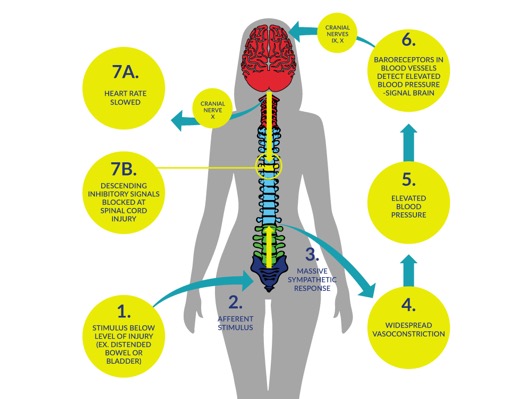 Pathophysiology of AD - SCIRE Professional